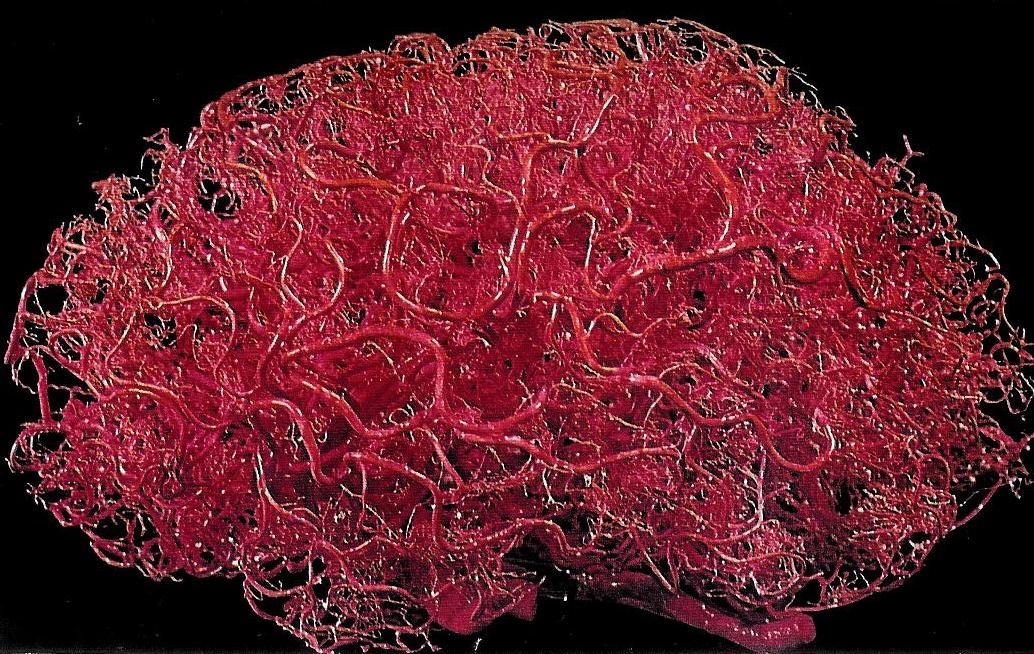 Vasi sanguigni nel cervello - Foto tonyb